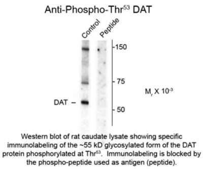 Western Blot: SLC6A3/DAT1 [p Thr53] Antibody [NBP2-29533]